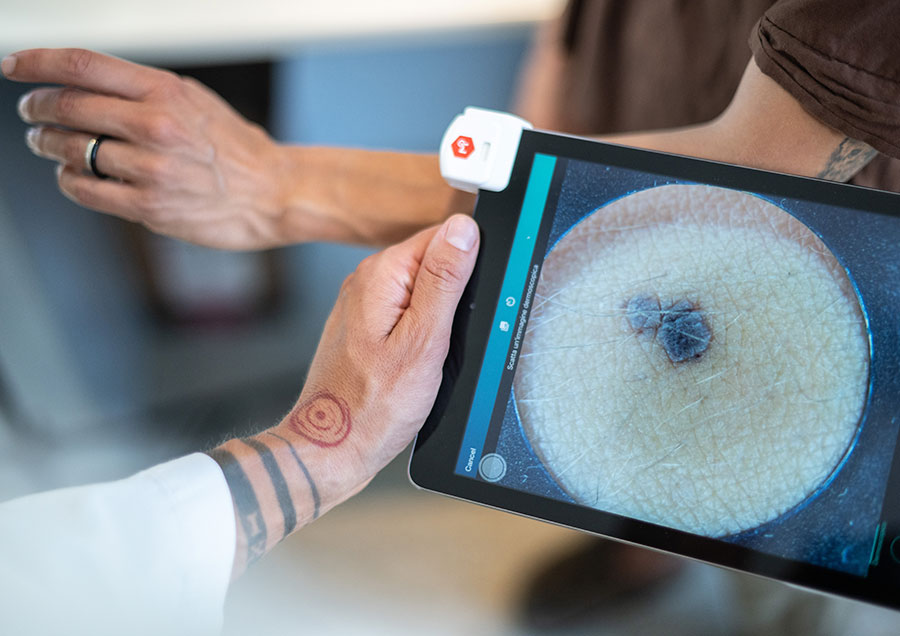 Dermatologo che analizza su tablet l'immagine dermoscopica di una lesione cutanea acquisita in farmacia per la teledermatologia