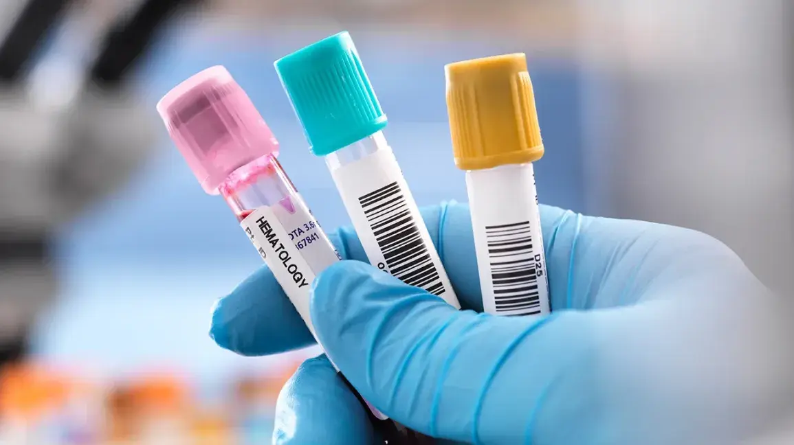 Provette per analisi del sangue tenute da operatore sanitario con guanti, utilizzate per il dosaggio della creatininemia